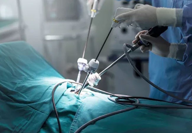 Laparoscopic Surgery in Kochi